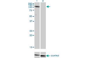 Western blot analysis of CLCN2 over-expressed 293 cell line, cotransfected with CLCN2 Validated Chimera RNAi (Lane 2) or non-transfected control (Lane 1). (CLCN2 antibody  (AA 38-387))