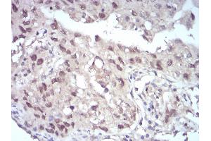 Immunohistochemistry (IHC) image for anti-Enhancer of Zeste Homolog 2 (EZH2) (AA 1-194) antibody (ABIN5542715)
