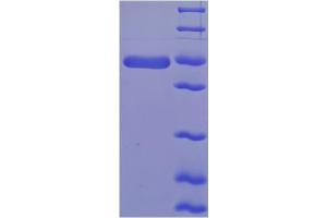 SDS-PAGE (SDS) image for Hydroxysteroid (17-Beta) Dehydrogenase 10 (HSD17B10) (AA 2-261) protein (His-SUMO Tag) (ABIN4975977)