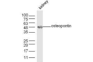 Mouse kidney lysates probed with Osteopontin Polyclonal Antibody, unconjugated  at 1:300 overnight at 4°C followed by a conjugated secondary antibody at 1:10000 for 60 minutes at 37°C. (Osteopontin antibody  (AA 141-220))