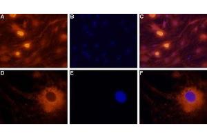 Expression of neuropeptide Y2 receptor in rat dorsal root ganglion cells - Immunocytochemical staining of rat dorsal root ganglion (DRG) neurons. (NPY2R antibody  (C-Term, Intracellular))
