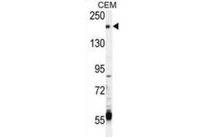 Western Blotting (WB) image for anti-Transient Receptor Potential Cation Channel, Subfamily M, Member 6 (TRPM6) antibody (ABIN3003652)