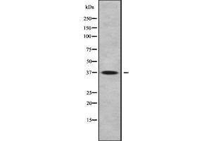 Western blot analysis FAIM2 using COLO205 whole cell lysates