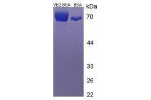 Image no. 2 for Vitamin B2 (Riboflavin) protein (BSA) (ABIN1880198)