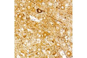 Immunohistochemistry of paraffin-embedded mouse spinal cord using ENO2 Rabbit mAb (ABIN7266959) at dilution of 1:100 (40x lens). (ENO2/NSE antibody)