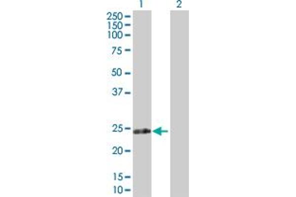 Ribose 5-Phosphate Isomerase A (RPIA) (AA 1-237) antibody