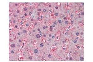 anti-APOA1 antibody was used at a 5 ug/ml to detect signal in human liver tissue. (APOA1 antibody)