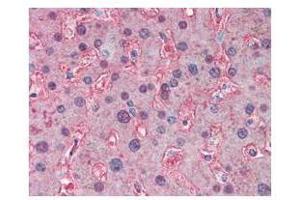 anti-APOA1 antibody was used at a 5 ug/ml to detect signal in human liver tissue.