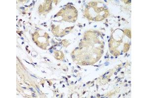 Immunohistochemistry of paraffin-embedded Human stomach using NID1 Polyclonal Antibody at dilution of 1:100 (40x lens). (Nidogen 1 antibody)