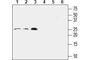 Western blot analysis of rat lung (lanes 1 and 4, 1:200), mouse heart (lanes 2 and 5, 1:200) and rat aortic endothelial cell (RAEC) (lanes 3 and 6, 1:400) lysates: - 1-3. (RAMP2 antibody  (Extracellular, N-Term))