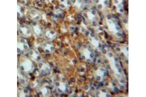 IHC-P analysis of Kidney tissue, with DAB staining. (IRF3 antibody  (AA 1-360))