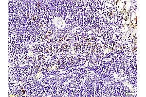 Formalin-fixed and paraffin embedded rabbit pancreas labeled with Anti-Bcl-2 Polyclonal Antibody, Unconjugated (ABIN707156) followed by conjugation to the secondary antibody and DAB staining (Bcl-2 antibody  (AA 161-239))