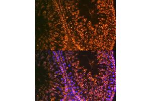 Immunofluorescence analysis of rat testis using Lin28 Rabbit mAb (ABIN7268266) at dilution of 1:100 (40x lens). (LIN28A antibody)