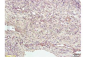 Formalin-fixed and paraffin embedded rat bile duct tissue labeled with Anti-CD34 Polyclonal Antibody, Unconjugated (ABIN676898) at 1:200 followed by conjugation to the secondary antibody and DAB staining (CD34 antibody  (AA 201-300))