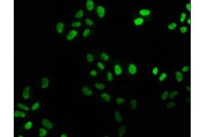 Immunofluorescence staining of Hela cells with ABIN7127487 at 1:25, counter-stained with DAPI. (Recombinant FEN1 antibody)