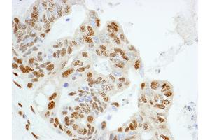 Immunohistochemistry (IHC) image for anti-Karyopherin (Importin) alpha 4 (KPNA4) (AA 471-521) antibody (ABIN7448983) (KPNA4 antibody  (AA 471-521))