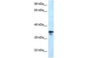Image no. 1 for anti-Methylmalonic Aciduria (Cobalamin Deficiency) CblC Type, with Homocystinuria (MMACHC) (AA 190-239) antibody (ABIN6747634)