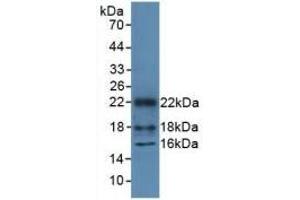 Detection of Recombinant HMGN1, Mouse using Polyclonal Antibody to High Mobility Group Nucleosome Binding Domain Protein 1 (HMGN1) (HMGN1 antibody  (AA 1-96))