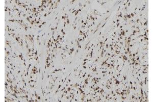 ABIN6273024 at 1/100 staining Human gastric tissue by IHC-P. (USP39 antibody  (N-Term))