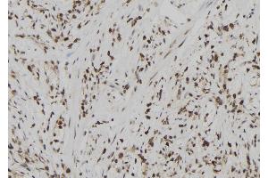 ABIN6273024 at 1/100 staining Human gastric tissue by IHC-P.