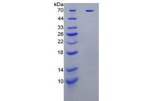 SDS-PAGE analysis of Human KIR2DL1 Protein. (KIR2DL1 Protein)