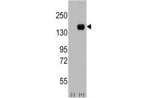 Western blot analysis of ASK1 antibody and 293 cell lysate (2 ug/lane) either nontransfected (Lane 1) or transiently transfected with the MAP3K5 gene (2). (ASK1 antibody  (AA 944-973))