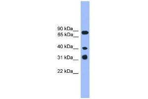 Western Blot showing LAX1 antibody used at a concentration of 1-2 ug/ml to detect its target protein. (LAX1 antibody  (C-Term))