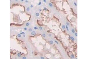 IHC-P analysis of Human Tissue, with DAB staining. (SLC3A2 antibody  (AA 270-406))