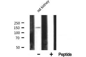 Western blot analysis of PLCG1 expression in rat kidney tissue lysates,The lane on the right is treated with the antigen-specific peptide. (Phospholipase C gamma 1 antibody)
