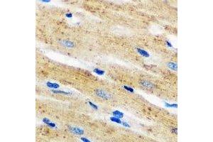 Immunohistochemical analysis of p67 phox staining in mouse heart formalin fixed paraffin embedded tissue section. (NCF2 antibody)