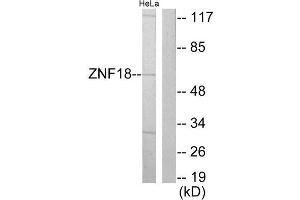 Western Blotting (WB) image for anti-Zinc Finger Protein 18 (ZNF18) (Internal Region) antibody (ABIN1849190) (ZNF18 antibody  (Internal Region))