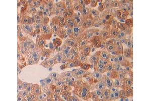Used in DAB staining on fromalin fixed paraffin- embedded Kidney tissue (LYPLA1 antibody  (AA 1-230))