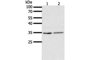 Western Blot analysis of Human fetal lung tissue and A549 cell using SFTPA1 Polyclonal Antibody at dilution of 1:300 (Surfactant Protein A1 antibody)