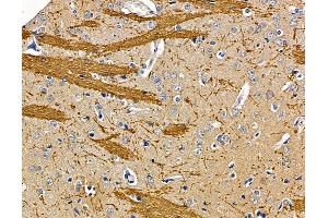 ABIN7095927 and ABIN7099989 at 1/100 staining rat brain tissue by IHC-P. (DDX26B antibody)