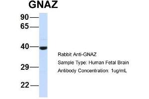 Host:  Rabbit  Target Name:  GNAZ  Sample Type:  Human Fetal Brain  Antibody Dilution:  1. (GNaZ antibody  (N-Term))