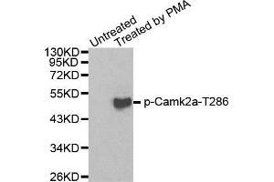 Western blot analysis of extracts from 293 cells using Phospho-Camk2a-T286 antibody. (CAMK2A antibody  (pThr286))