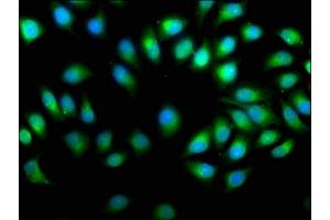 Immunofluorescence staining of A549 cells with ABIN7164792 at 1:50, counter-stained with DAPI. (PREP antibody  (AA 539-691))