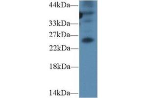 Detection of GREM1 in Mouse Spleen lysate using Polyclonal Antibody to Gremlin 1 (GREM1) (GREM1 antibody  (AA 25-184))