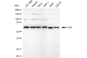 anti-Fused in Sarcoma (FUS) antibody