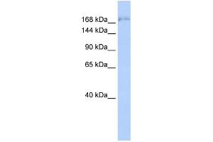 WB Suggested Anti-SUPT6H Antibody Titration: 0.
