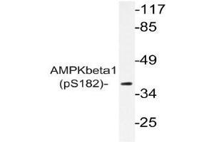 Western blot (WB) analysis of p-AMPKbeta1 antibody in extracts from COS7 cells (PRKAB1 antibody  (pSer182))