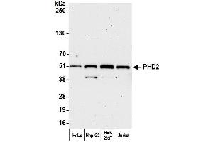 anti-Egl-9 Family Hypoxia Inducible Factor 1 (EGLN1) (AA 1-50) antibody