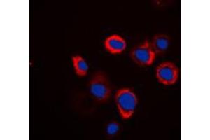 Immunofluorescent analysis of Renin Receptor staining in Raw264. (ATP6AP2 antibody  (Center))