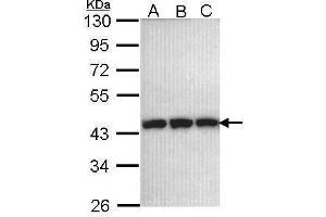 WB Image Sample (30 ug of whole cell lysate) A: 293T B: A431 , C: H1299 10% SDS PAGE antibody diluted at 1:1000 (PGK1 antibody)