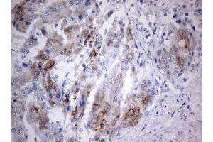 Immunohistochemistry (IHC) image for anti-Chromosome 3 Open Reading Frame 15 (C3orf15) (AA 1-313) antibody (ABIN2715591) (C3orf15 antibody  (AA 1-313))