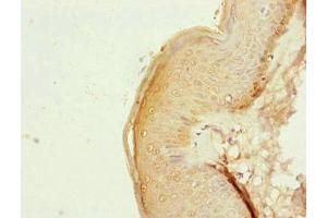 NDUFB1 antibody  (AA 1-172)