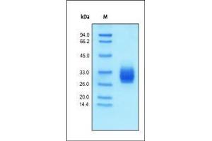 Human EMMPRIN, His Tag on SDS-PAGE under reducing (R) condition. (CD147 Protein (AA 22-205) (His tag))