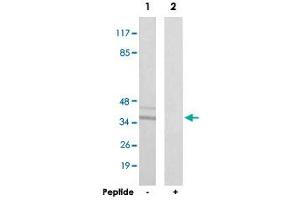 Western blot analysis of extracts from LoVo cells, using CTU1 polyclonal antibody . (ATPBD3 antibody  (C-Term))