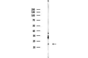 anti-Adrenomedullin (ADM) (N-Term) antibody
