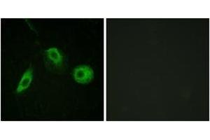 Immunofluorescence analysis of HeLa cells, using PLCG2 (Phospho-Tyr1217) Antibody. (Phospholipase C gamma 2 antibody  (pTyr1217))
